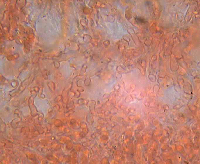 Mycoacia uda